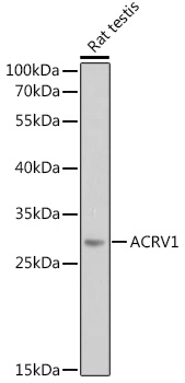 ACRV1 Rabbit pAb