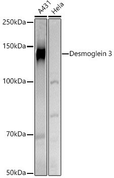 Desmoglein 3 Rabbit pAb
