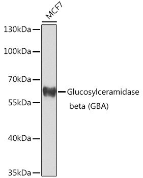 Glucosylceramidase beta (GBA) Rabbit pAb