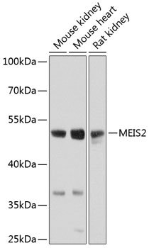 MEIS2 Rabbit pAb