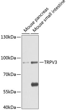 TRPV3 Rabbit pAb