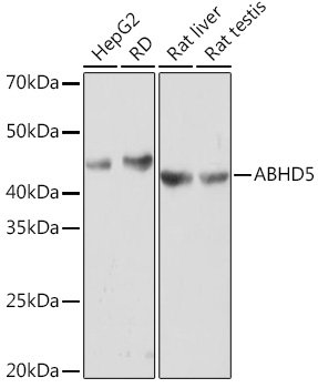 ABHD5 Rabbit mAb