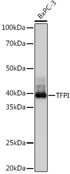 TFPI Rabbit mAb