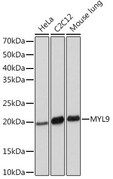 MYL9 Rabbit mAb