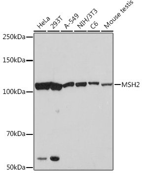 MSH2 Rabbit mAb