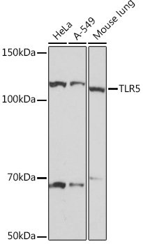 TLR5 Rabbit mAb