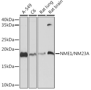 NME1/NM23A Rabbit mAb