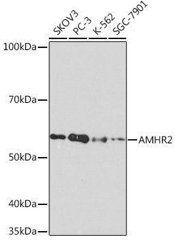 AMHR2 Rabbit mAb