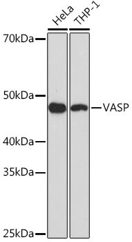 VASP Rabbit mAb
