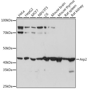 Arp2 Rabbit mAb