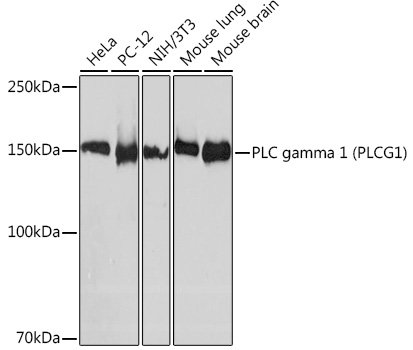 PLC gamma 1 (PLCG1) Rabbit mAb