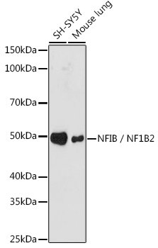 NFIB / NF1B2 Rabbit mAb