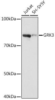 GRK3 Rabbit mAb