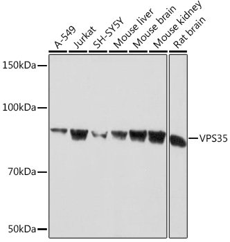 VPS35 Rabbit mAb