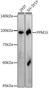 PPM1E Rabbit mAb