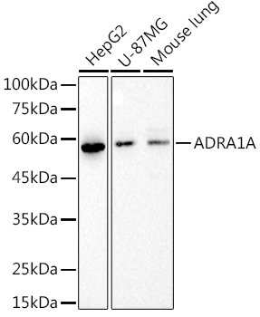 ADRA1A Rabbit mAb