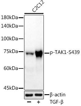 Phospho-TAK1-S439 Rabbit mAb