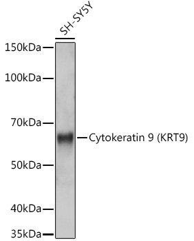 Cytokeratin 9 (KRT9) Rabbit mAb