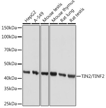 TIN2/TINF2 Rabbit mAb