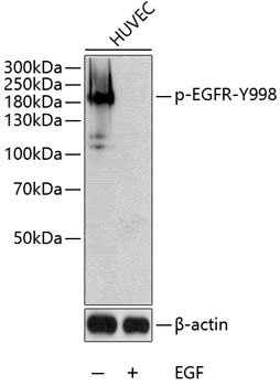 Phospho-EGFR-Y998 Rabbit pAb