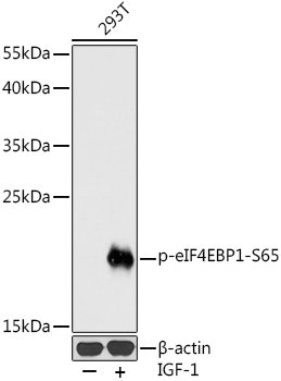 Phospho-eIF4EBP1-S65 Rabbit pAb