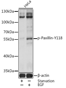 Phospho-Paxillin-Y118 Rabbit pAb