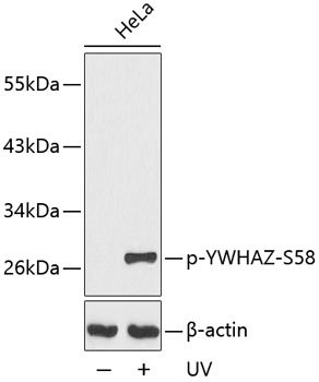 Phospho-YWHAZ-S58 Rabbit pAb