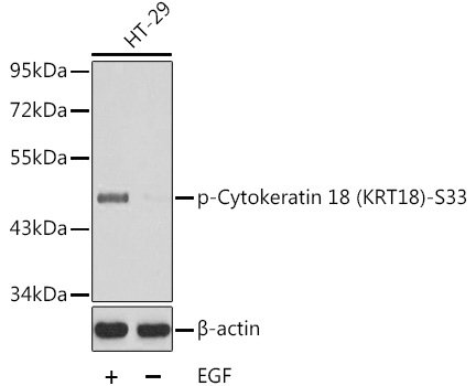 Phospho-Cytokeratin 18 (KRT18)-S33 Rabbit pAb