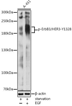 Phospho-ErbB3/HER3-Y1328 Rabbit pAb