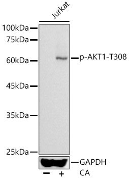 Phospho-AKT1-T308 Rabbit pAb