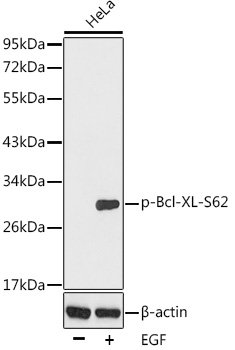 Phospho-Bcl-XL-S62 Rabbit pAb