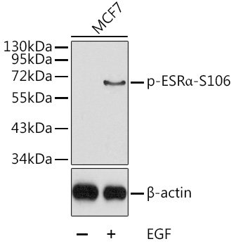 Phospho-ESRα-S106 Rabbit pAb