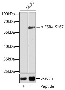 Phospho-ESRα-S167 Rabbit pAb