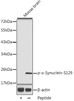 Phospho-α-Synuclein-S129 Rabbit pAb