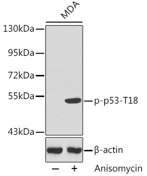 Phospho-p53-T18 Rabbit pAb