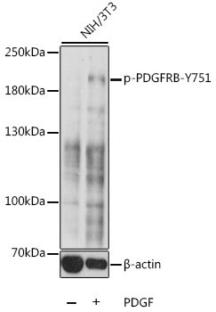 Phospho-PDGFRB-Y751 Rabbit pAb