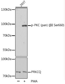 Phospho-PKC (pan) (βII Ser660) Rabbit pAb