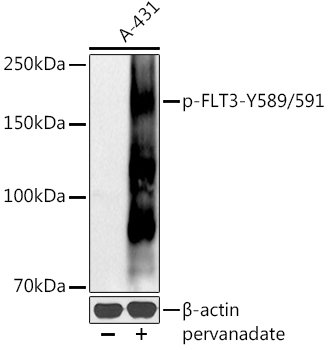 Phospho-FLT3-Y589/591 Rabbit pAb