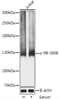 Phospho-RB-S608 Rabbit pAb