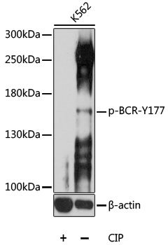 Phospho-BCR-Y177 Rabbit pAb