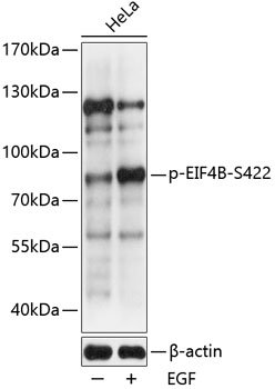 Phospho-EIF4B-S422 Rabbit pAb