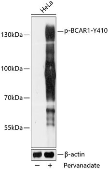 Phospho-BCAR1-Y410 Rabbit pAb