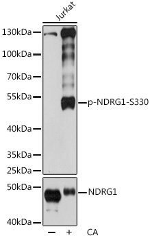 Phospho-NDRG1-S330 Rabbit pAb