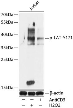 Phospho-LAT-Y171 Rabbit pAb