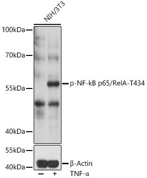 Phospho-NF-kB p65/RelA-T435 Rabbit pAb