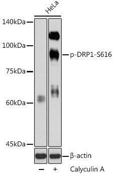 Phospho-DRP1-S616 Rabbit pAb