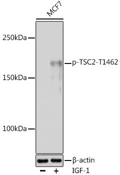 Phospho-TSC2-T1462 Rabbit pAb