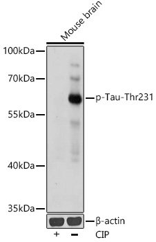 Phospho-Tau-T231 Rabbit pAb