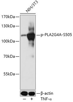Phospho-PLA2G4A-S505 Rabbit pAb