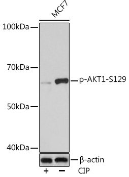 Phospho-AKT1-S129 Rabbit mAb